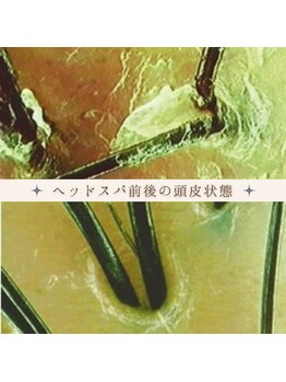 ベル(belle)/ヘッドスパ前後の頭皮状態