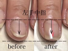 ロイネイル 鹿嶋店(LOInail)/育成3ヶ月コース