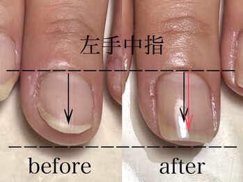 ロイネイル 鹿嶋店(LOInail)/育成3ヶ月コース