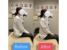 ナオル整体 宮崎院(NAORU整体)/20代女性施術事例【猫背改善】