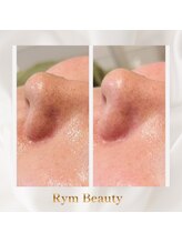 リム ビューティー(RYM BEAUTY)/毛穴ケアや毛穴引き締めにも