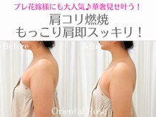 オリエンタルローザ 表参道(Oriental Rosa)/大人気★肩コリ燃焼サイズダウン