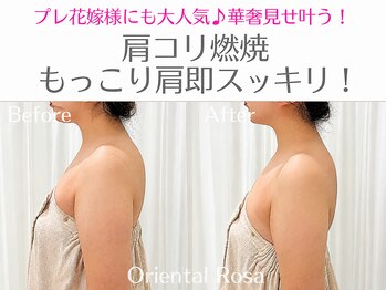 オリエンタルローザ 表参道(Oriental Rosa)/大人気★肩コリ燃焼サイズダウン