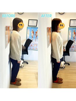 心斎橋長堀フェムテック整骨院/猫背矯正 心斎橋 姿勢矯正