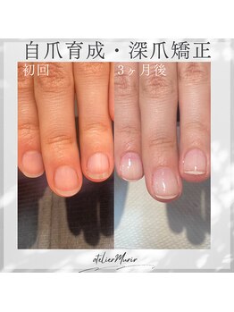 アトリエ ミュリー 代官山(atelier murir)/自爪育成・深爪矯正・巻き爪ケア