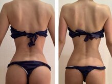 エイプリル/【痩身】比較写真