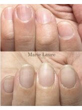 マリーロール 天王寺店(Marie Laure)/自爪育成/深爪矯正/ネイルケア