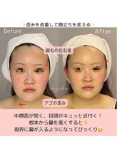 アンジェリカ(Angelica)/歪みや左右差を整えて卵形小顔に