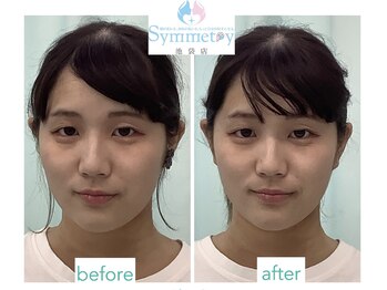 シンメトリー 池袋店