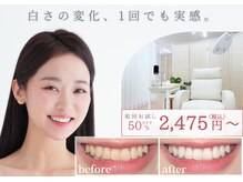 パドマ(padma)