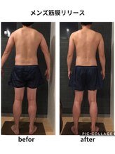 クリア(Clear)/メンズ筋膜リリース