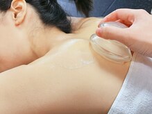 チェアアップジム 大森(Cheerup Gym)/コンディショニングカッピング