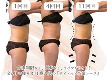 ヨサパーク ハグ 北野(YOSA PARK hug)/短期集中ダイエット！！！