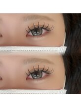 ノエル(Noel)/バインドロック120束 担当みゆう