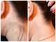 ルチル(LUTILU)の写真/【部分脱毛できるので初めての方にも◎】背中や二の腕など気になる部位ごとにツルスベ肌に