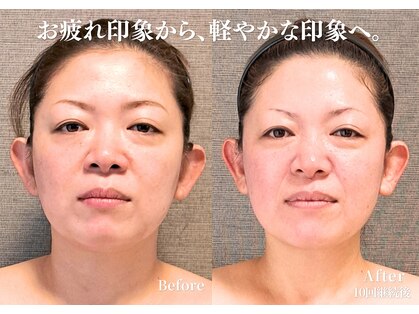 バンブー(bamboo)の写真