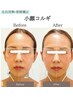 【小顔・美肌ケア】韓国式コルギ×スピルリナで鎮静×石膏パック80分￥9,800