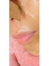 コーズィ(cozy)/《溜まった毛穴の汚れスッキリ》