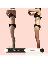 サンテボーテ(Sante Beaute)/猫背って改善するの？