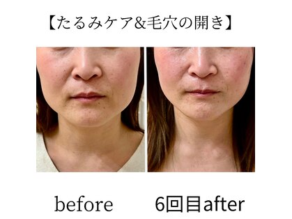 マリン(marin)の写真