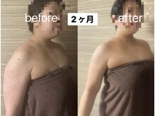 ライズサロン(RiseSALON)の雰囲気（見た目痩せに特化した痩身リンパマッサージ）