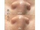 サロン ド ビューティー ラ デュースの写真