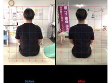 ストレチックス 近江八幡店/ストレッチ　ビフォーアフター