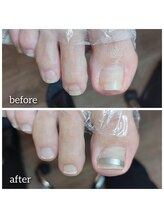 爪切り屋 足楽/