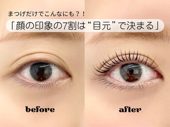 アイスリーループ(EYE38.)