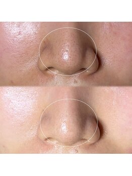 ソワ 吉塚店(soi)/汚れ落ちが半端ない!