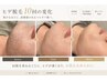メンズひげ脱毛お試し￥3,300男性専用個室完備