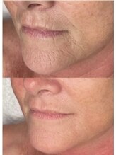 ファヴォリ(favori)/ゾンビマスク