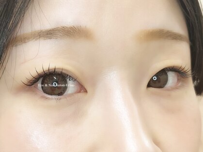 エムエスエー エクラ(MSA Eclat)の写真