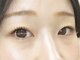 エムエスエー エクラ(MSA Eclat)の写真