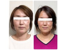 トッコボディケアの雰囲気（エラ/たるみ改善/ほうれい線/むくみ/くすみ/左右差なら当店へ）