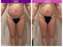 クレヴィア バイ サイバーエステ(CREBIA)/【ボディ回数券】【お腹集中】