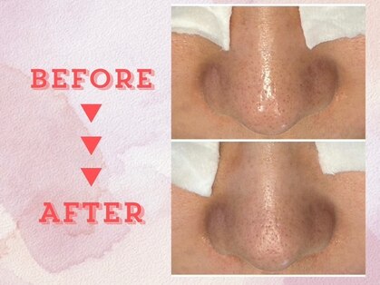 ソニア(SONIA)の写真