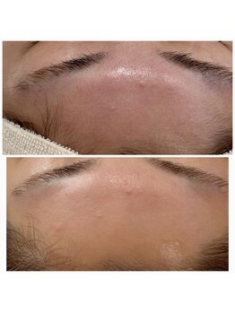 アネラ キキ サロン(anela kiki salon)/シェービングエステ