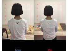 ストレチックス 近江八幡店/腰痛改善ビフォーアフター1回