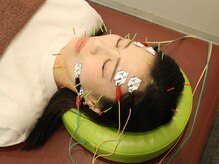 かんざき鍼灸接骨院/美容鍼/40本/電流リフト