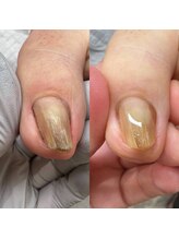 ハビッツ(habits)/ケア用ジェル