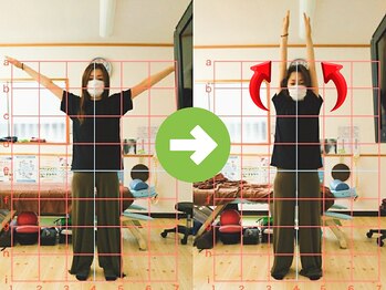 サプライズ整体院/20代ママさんの肩こり初回結果