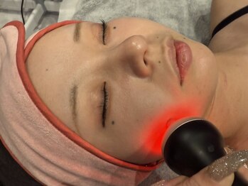 モア(MORE)の写真/超光リフトアップフォトで表情まで明るく！若々しい見た目を目指すなら今♪理想のフェイスラインへ導きます