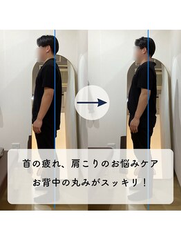 なぎのき鍼灸治療院/首の疲れ・肩こりのお悩みケア！