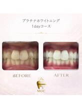 ドクターモック(Dr.MOC)/