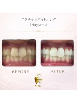 ドクターモック(Dr.MOC)/