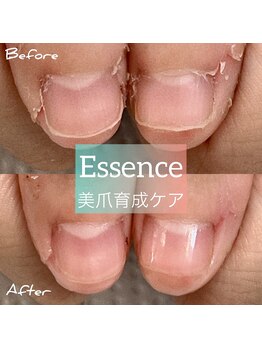 エッセンス (Essence)/美爪育成ケア