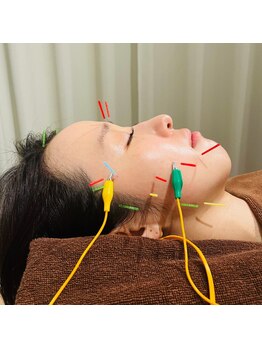 ベルルーナ(Belle-Lune)/美容鍼