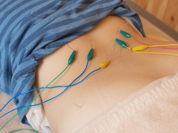 ハリナチュレ 五反田店/骨盤美腰鍼