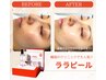 「水光肌」「芸能人肌」ララピールと噂の「整えヘッド」で変化の扉を開ける！